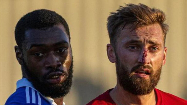 Liverpool fans are loving this photo that truly showcases Nathaniel Phillips dedication